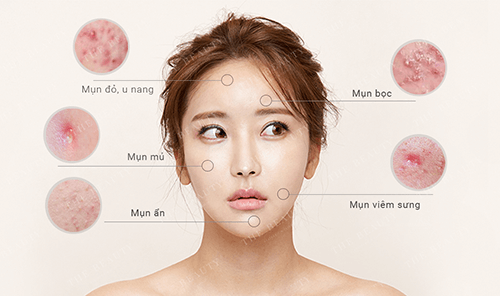 Trị Mụn Không Thuốc Tại Acne Studio - Công Nghệ An Toàn Hiệu Quả
