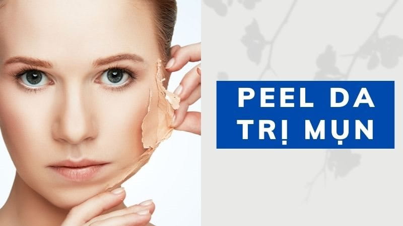 Điều Trị Mụn Bằng DPL Hiệu Quả Tại ACNE STUDIO