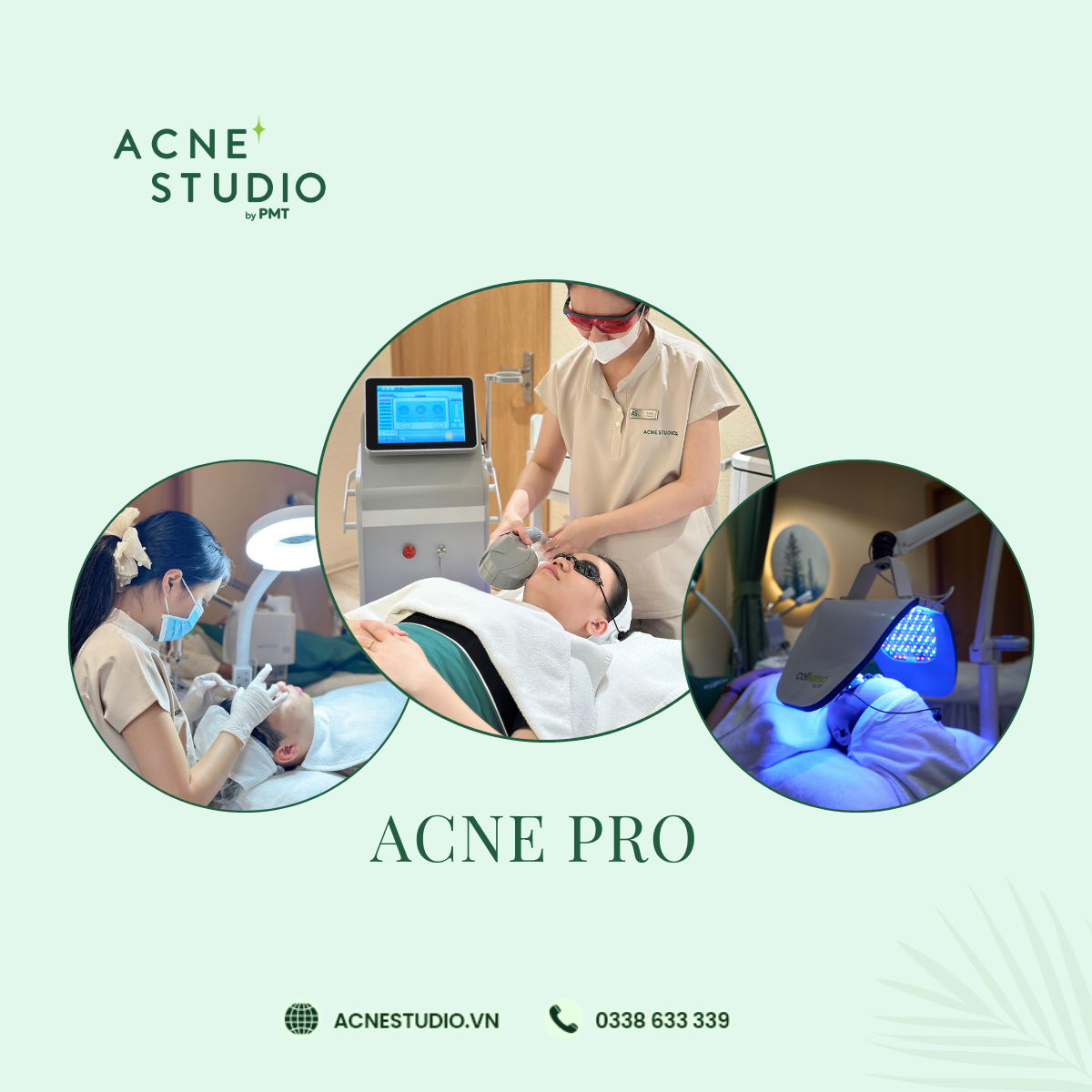 Liệu trình ACNE PRO 499k – Chăm sóc da mụn chuyên sâu 17 bước kết hợp công nghệ cao