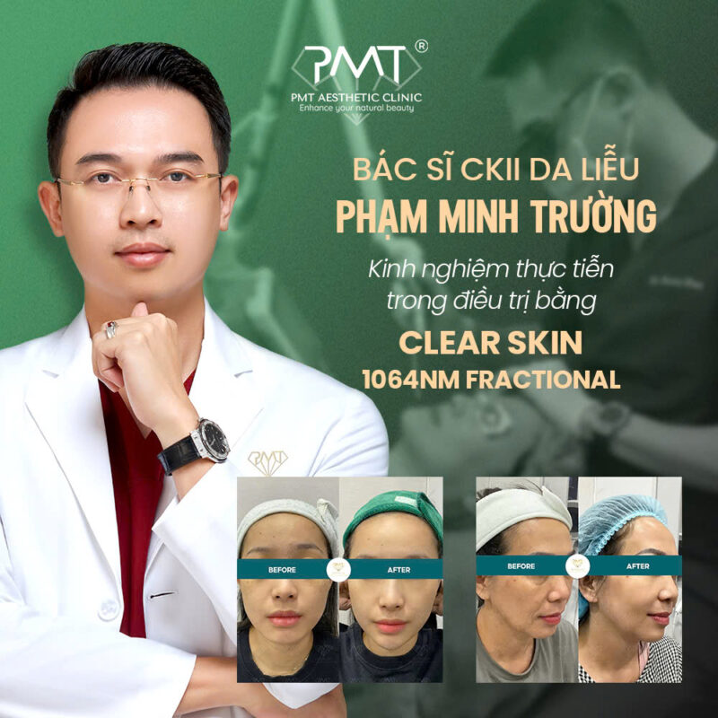 ACNE STUDIO by PMT Rạch Giá - Phòng khám da liễu hiện đại, trị mụn cá nhân hóa
