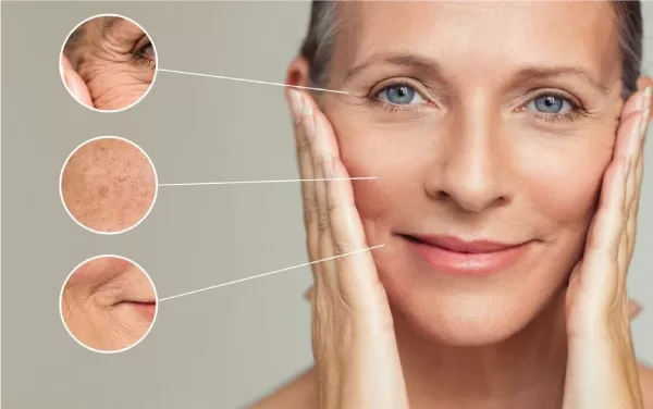 Ultherapy Prime là gì? Công nghệ nâng cơ trẻ hóa thế hệ mới 2026 tại PMT
