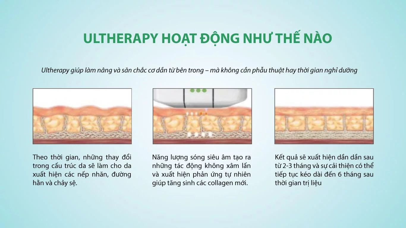 Khám Phá Hiệu Quả Nâng Cơ Vùng Mặt, Cổ với Ultherapy Prime