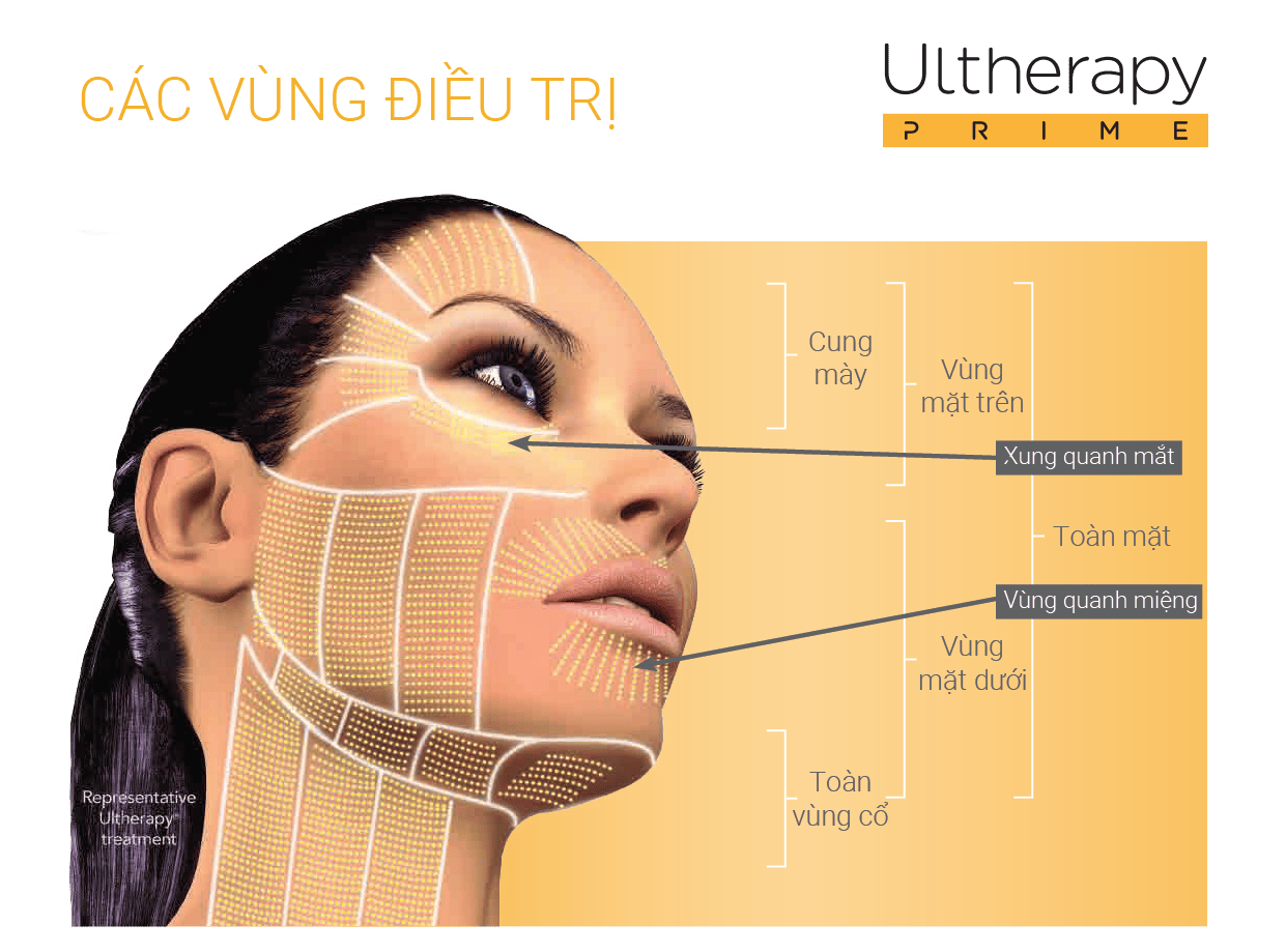 Khám Phá Hiệu Quả Nâng Cơ Vùng Mặt, Cổ với Ultherapy Prime
