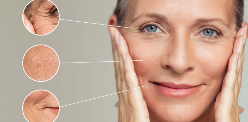 Ultherapy Prime hay Thermage: Lựa chọn phù hợp cho làn da của bạn