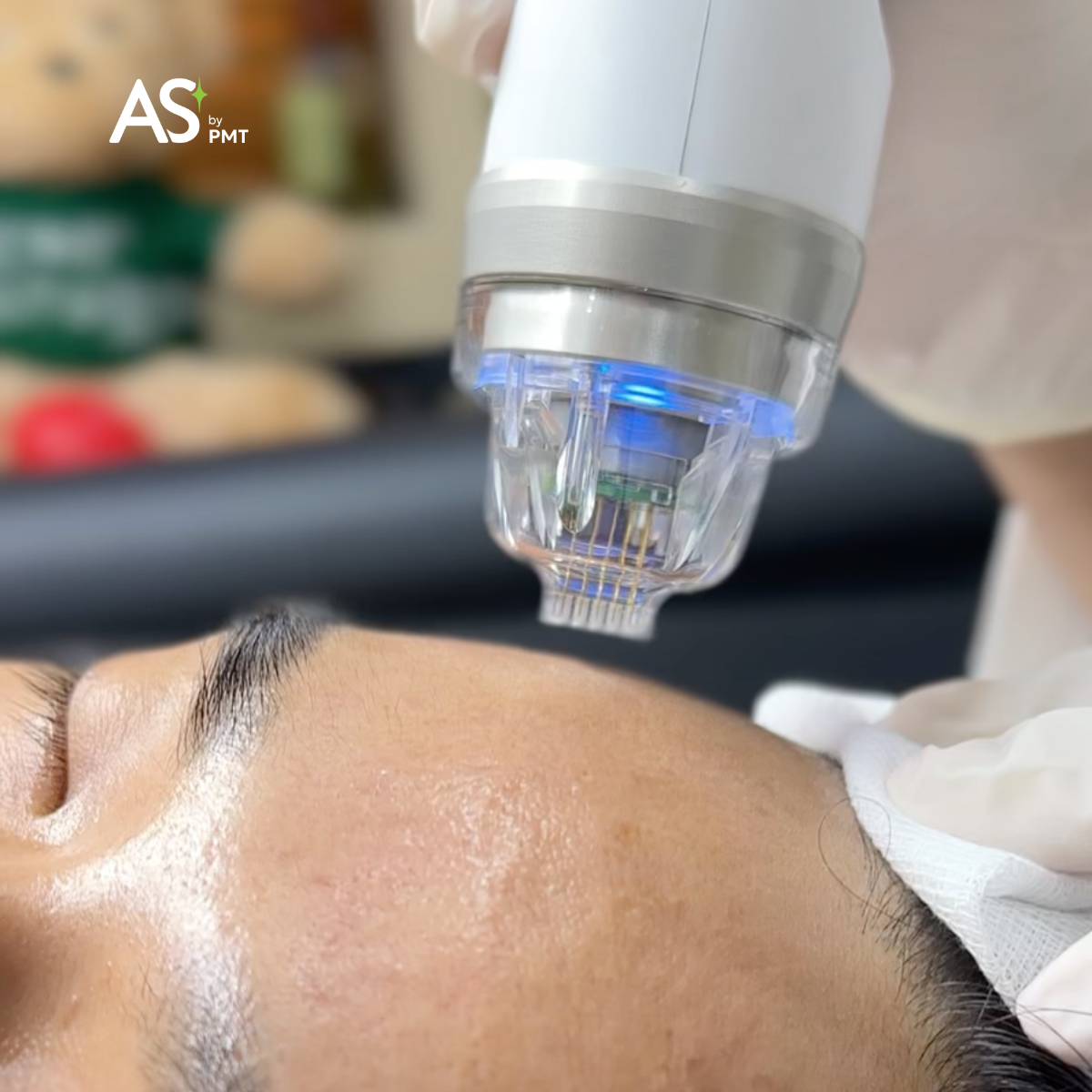 Công nghệ EndyMed PRO: Kiểm soát năng lượng đa tầng