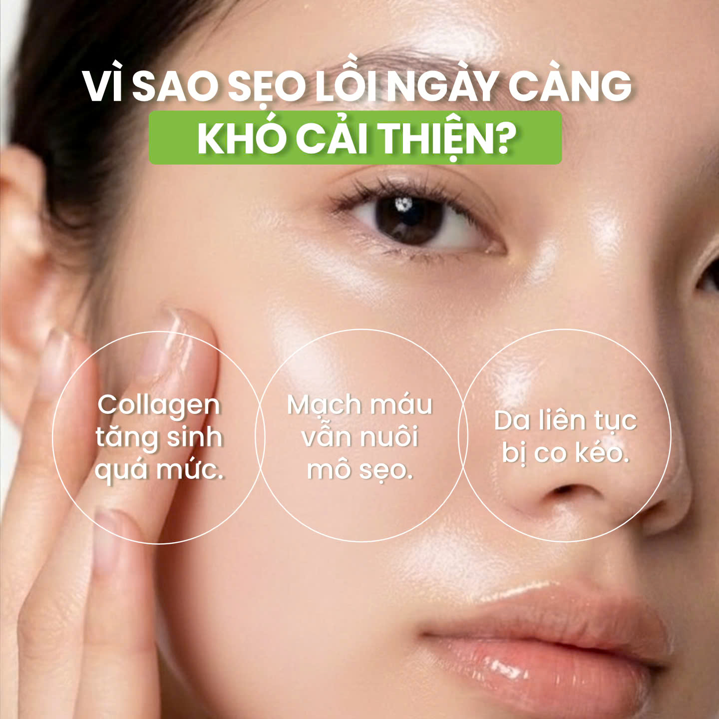 Ba lý do cốt lõi khiến sẹo lồi không thể tự mờ đi theo thời gian